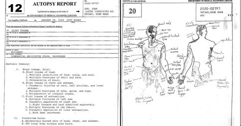 kobes autopsy|Autopsyfiles.org